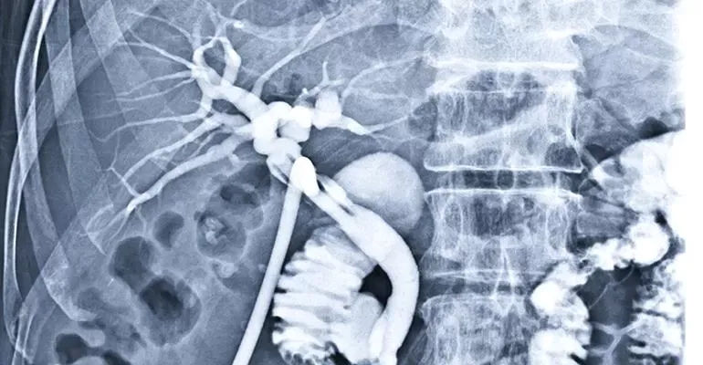 interventional radiology.jpg interventional radiology.jpg