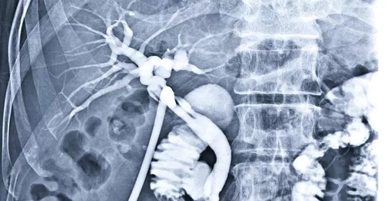 interventional radiology.jpg interventional radiology.jpg