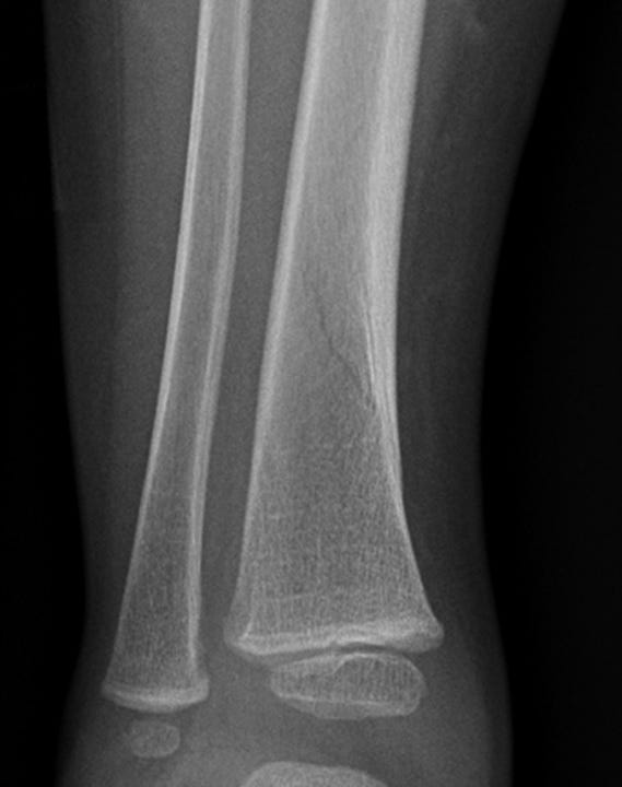 Painful_hip_figure_2.jpg Painful_hip_figure_2.jpg