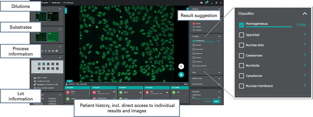 Fig_2_EUROPattern_software_results.jpg Fig_2_EUROPattern_software_results.jpg