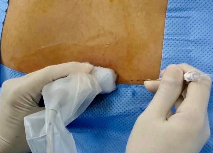 pain_management_during_pregnancy_Figure_1_0.jfif