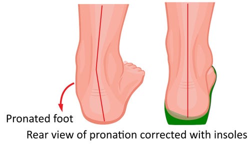 PronationRear.jpg PronationRear.jpg