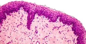 pathology image pathology image