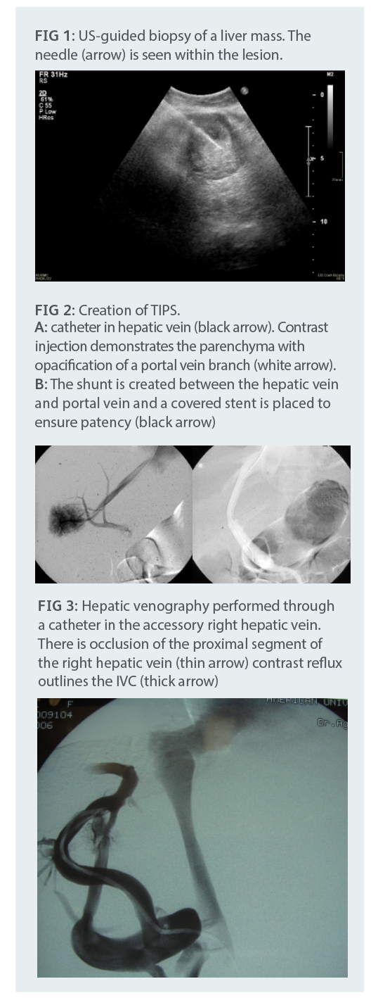 interventional_radiology_.png interventional_radiology_.png