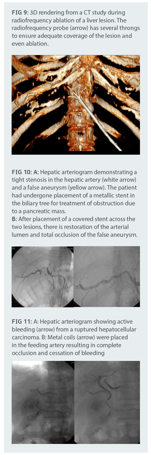 interventional_radiology_3.png interventional_radiology_3.png