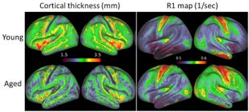 Figure_01_-_Okada.jpg Figure_01_-_Okada.jpg