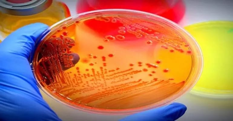 petri dish petri dish