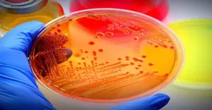 petri dish petri dish