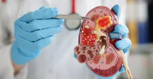 World Kidney Day World Kidney Day