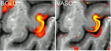 Figure_02_-_Okada.jpg Figure_02_-_Okada.jpg