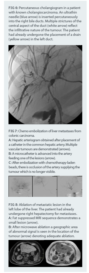 interventional_radiology_2.png interventional_radiology_2.png