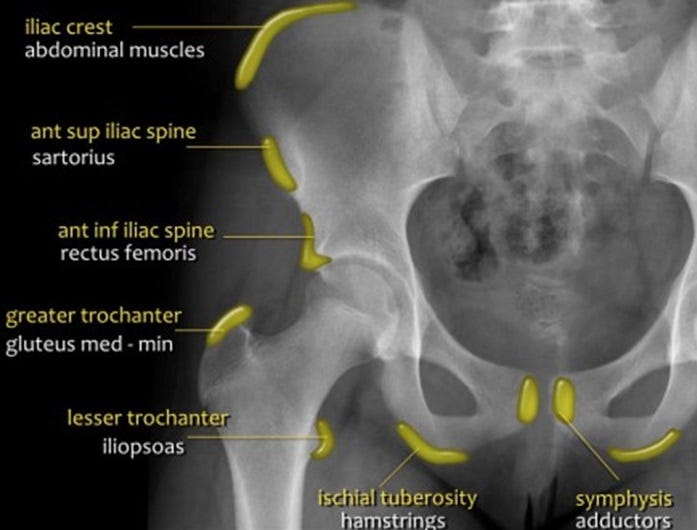 Painful_hip_figure_6.jpg Painful_hip_figure_6.jpg