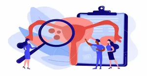 Endometriosis.jpg Endometriosis.jpg