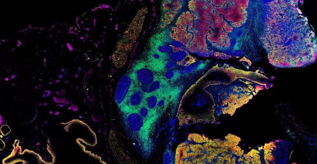 spatial phenotyping.jpg spatial phenotyping.jpg