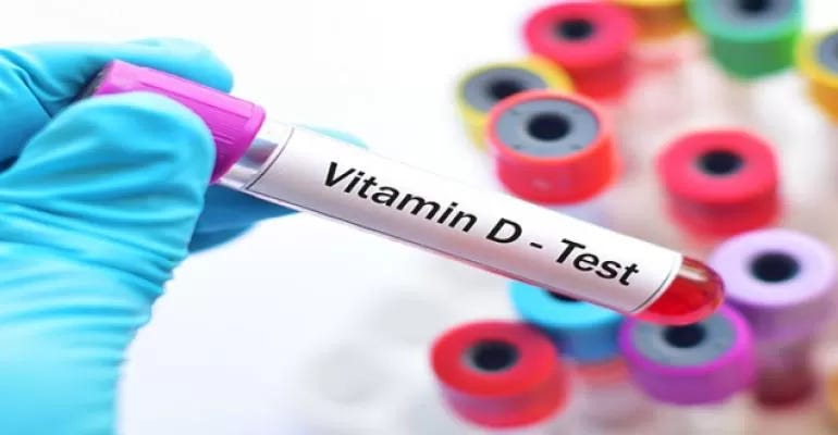 test tubes with labels test tubes with labels