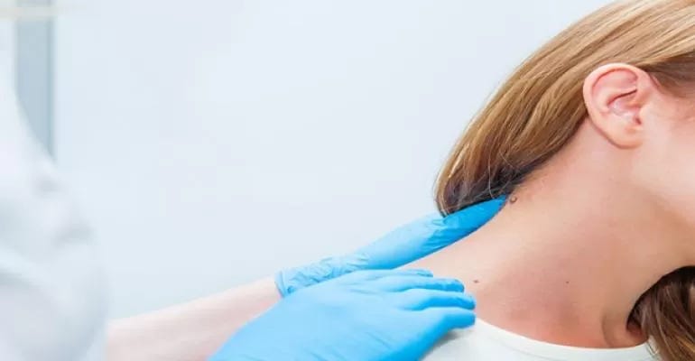 doctor checking skin doctor checking skin