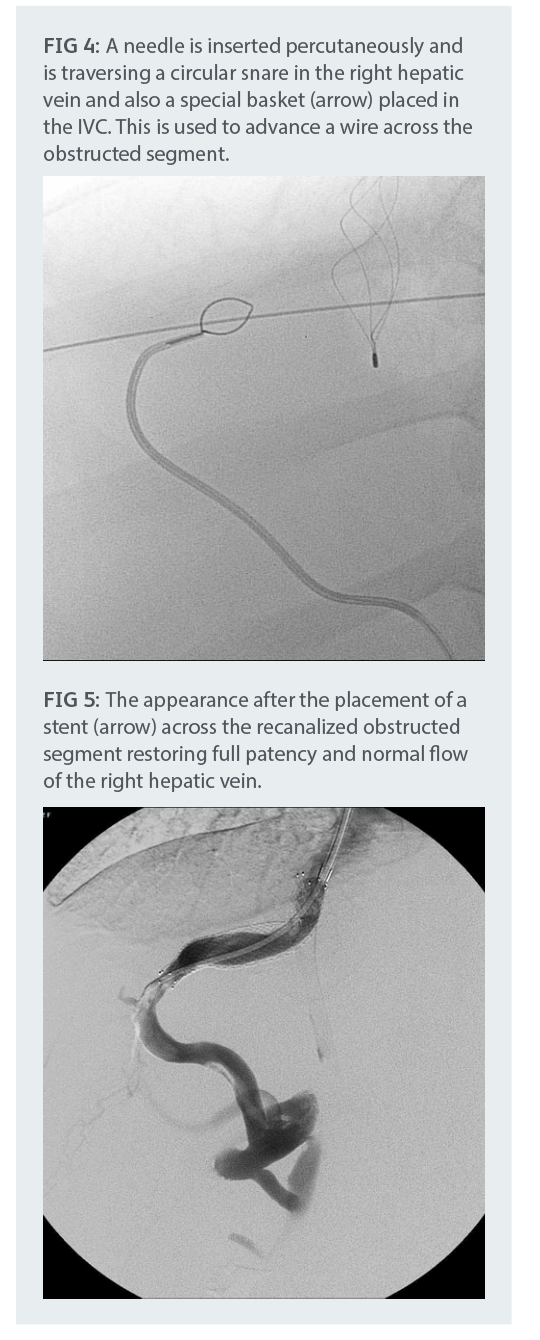 interventional_radiology_1.png interventional_radiology_1.png
