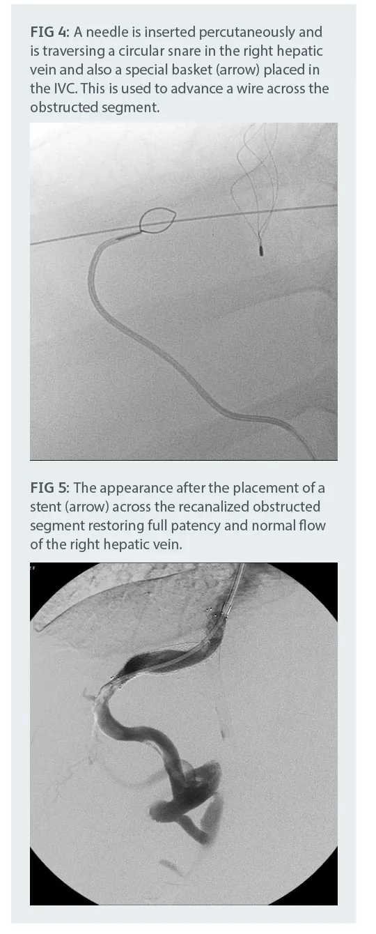 interventional_radiology_1.png interventional_radiology_1.png