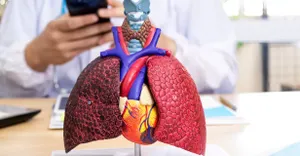 respiratory syncytial virus (rsv).png respiratory syncytial virus (rsv).png