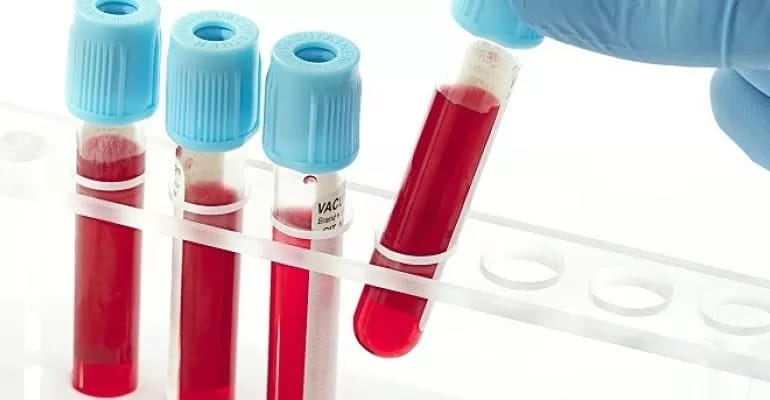 vaccine.jpg vaccine.jpg