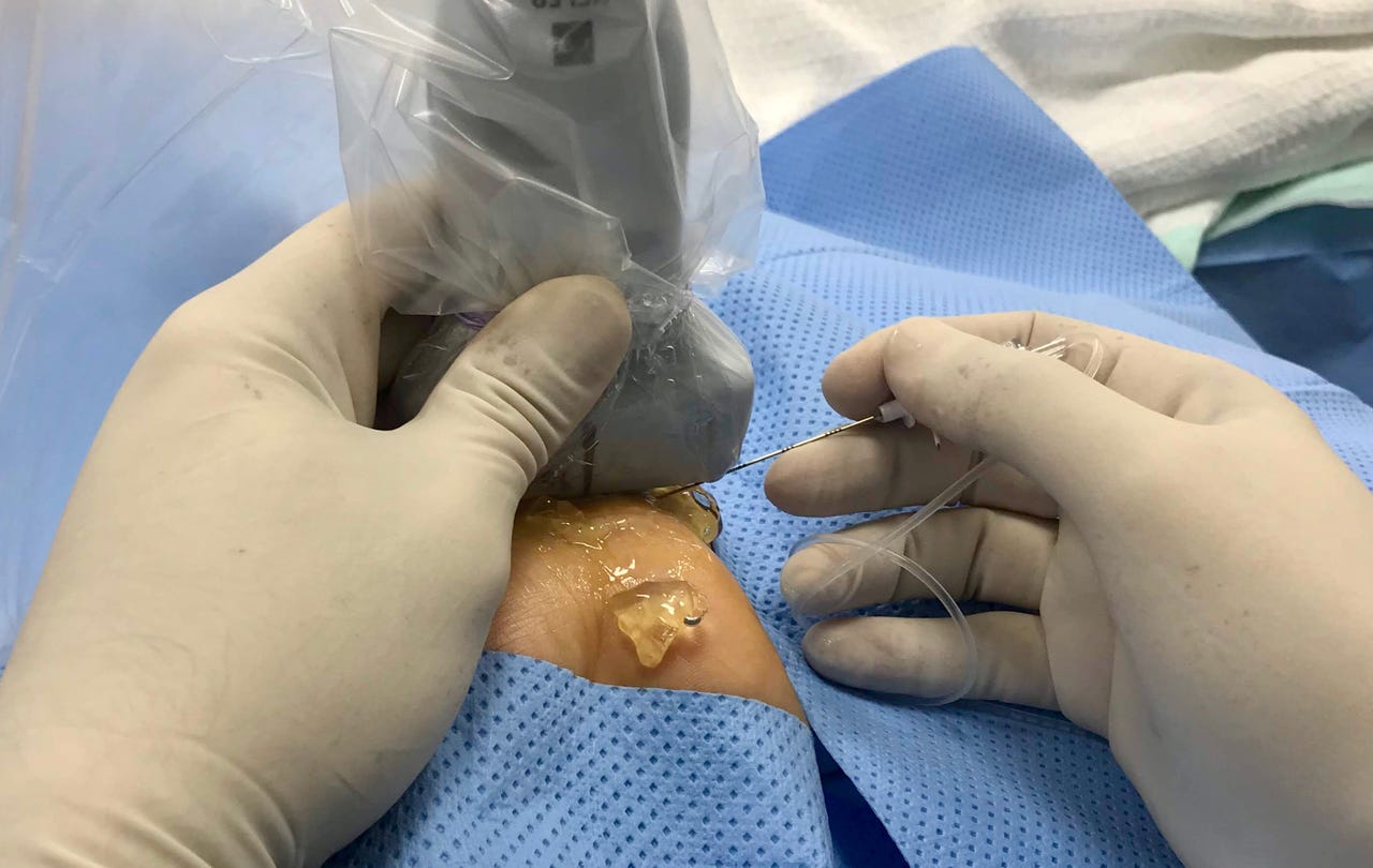 pain_management_during_pregnancy_Figure_2.jpg pain_management_during_pregnancy_Figure_2.jpg