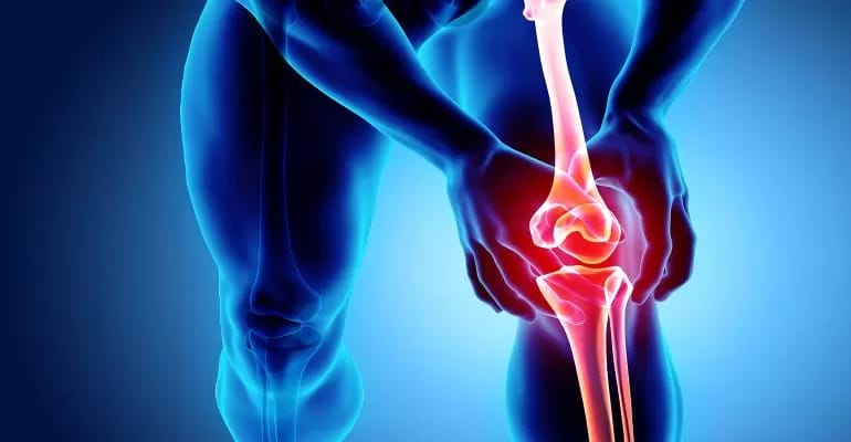 osteoarthritis.jpg osteoarthritis.jpg