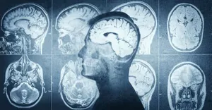 Radiology trend update Radiology trend update