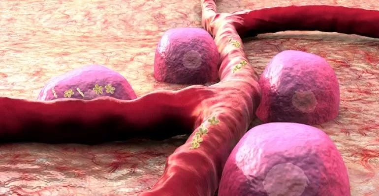 betacell.jpg betacell.jpg