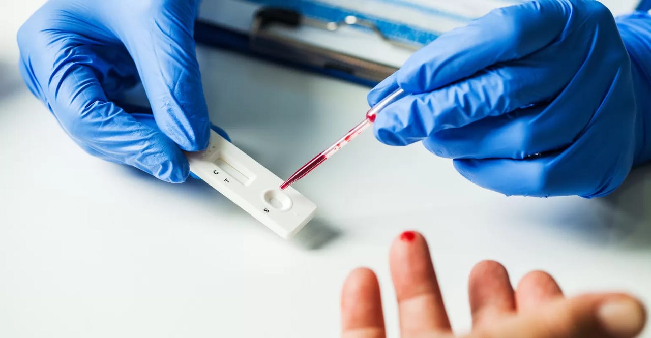 point of care testing point of care testing