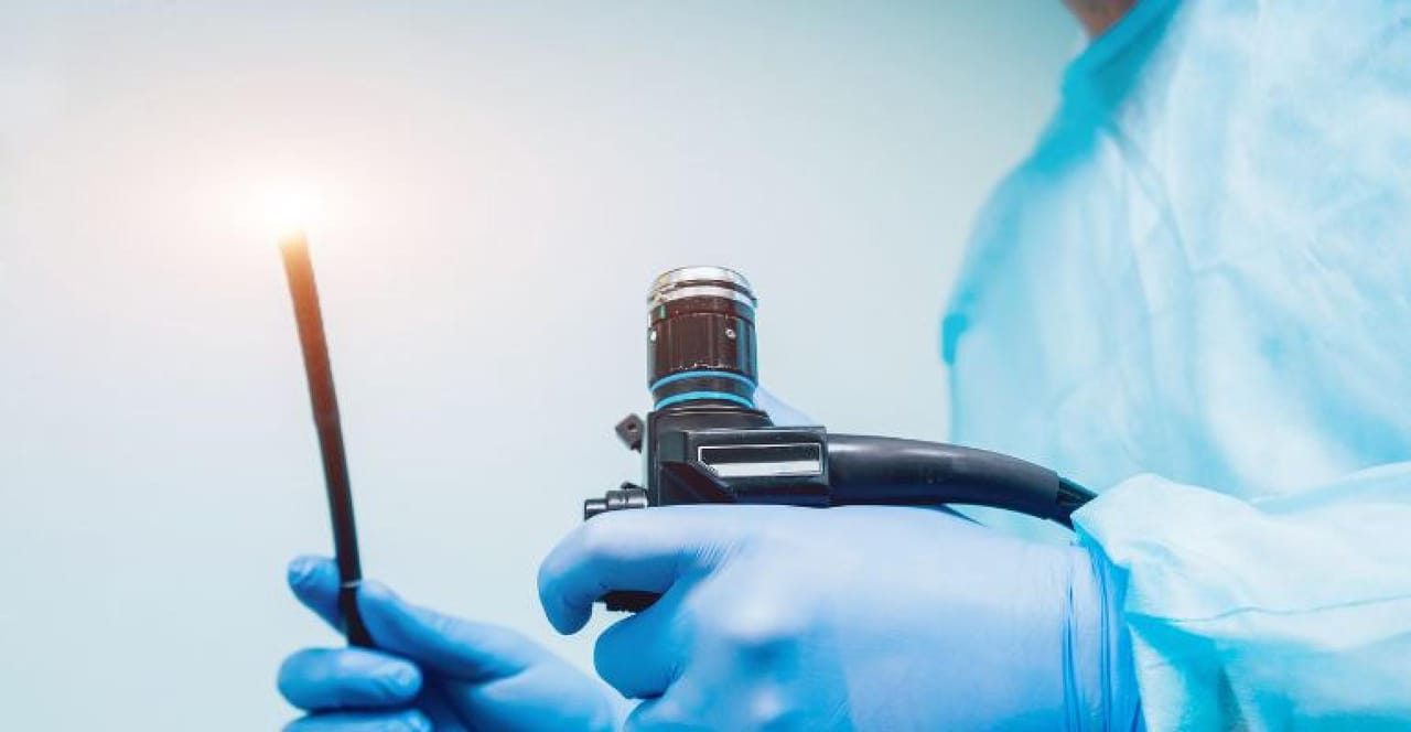 endoscopy.jpg endoscopy.jpg