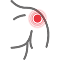 aliviar contusión muscular