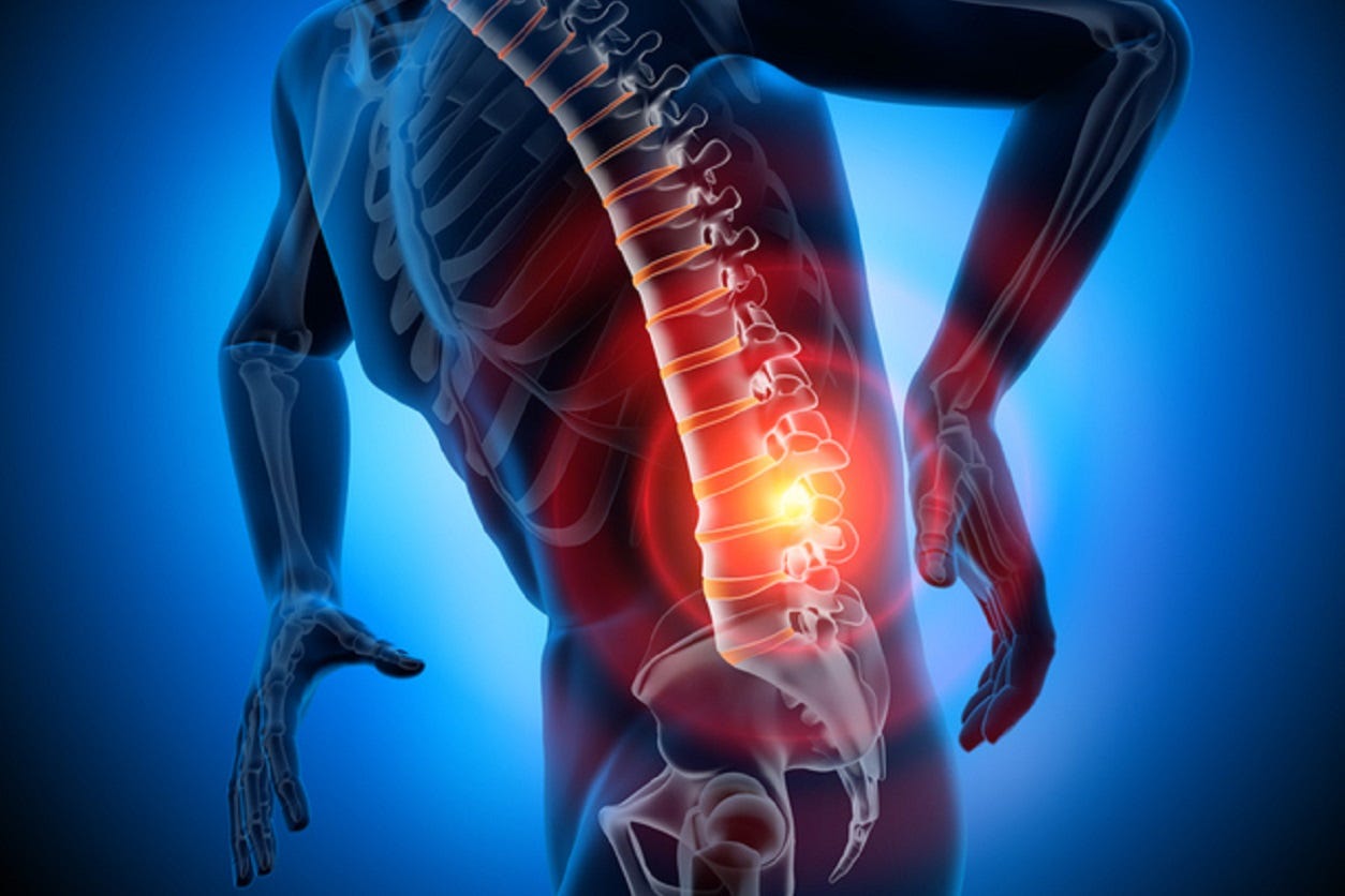 Causas del dolor de espalda baja