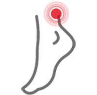 aliviar dolor de esguince