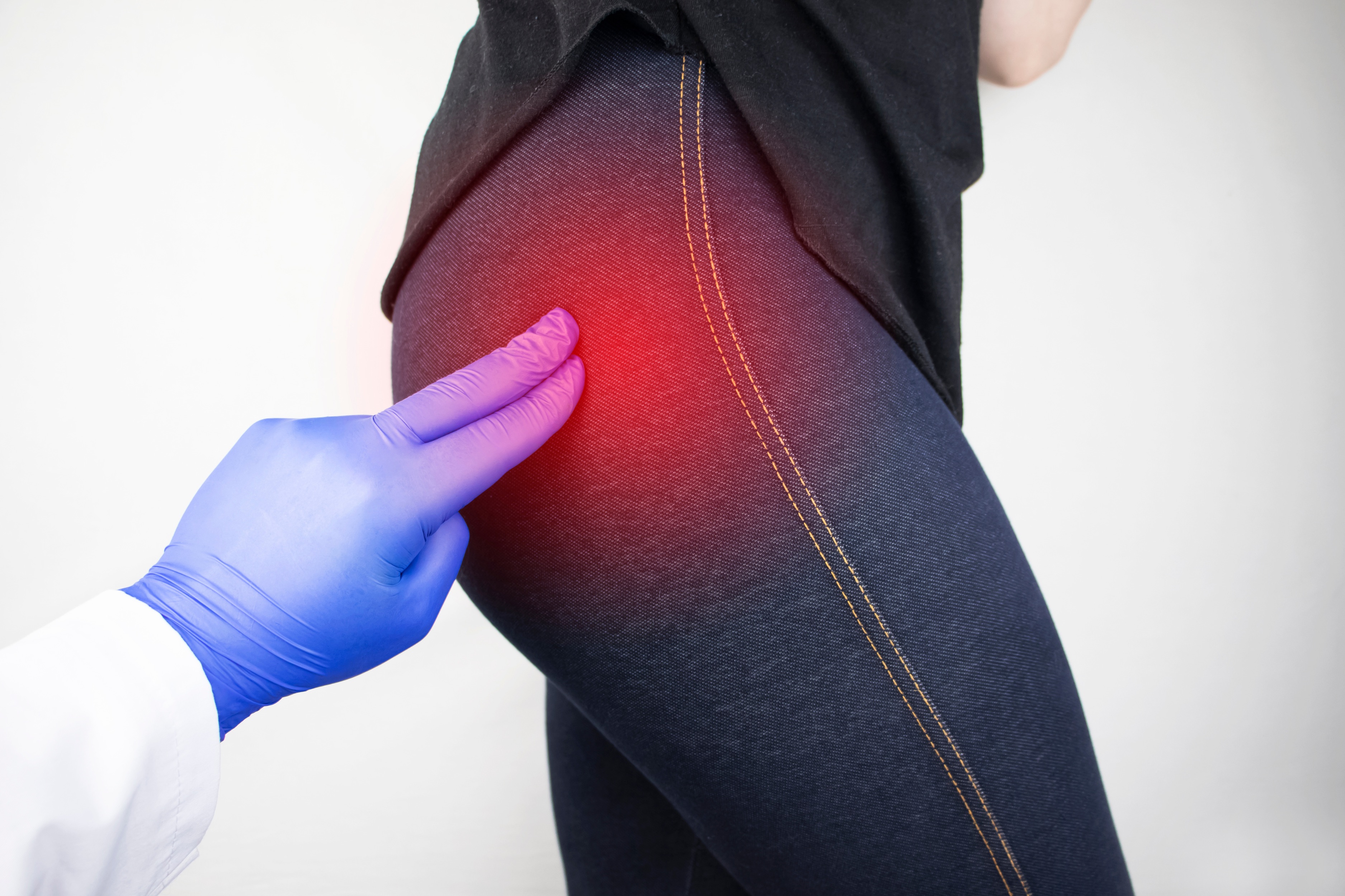 Para qué sirve Reflex Spray