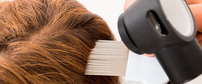 Como detectar los piojos y liendres