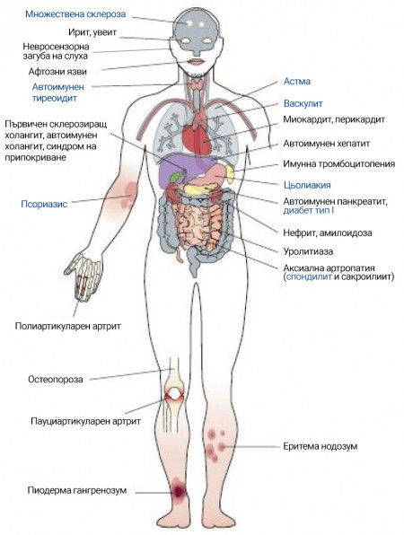 Crohn_about-disease_Възпаление_на_стомашно-чревния_тракт.jpg