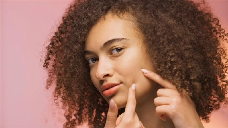 Acne Vs. Pimples: What’s The Difference?
