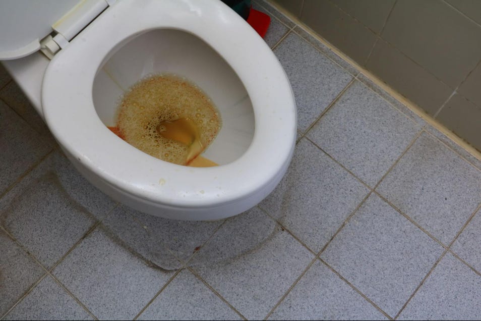 How to Remove Yellow Stains from Toilet