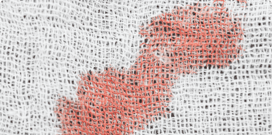 How to Remove Blood Stains