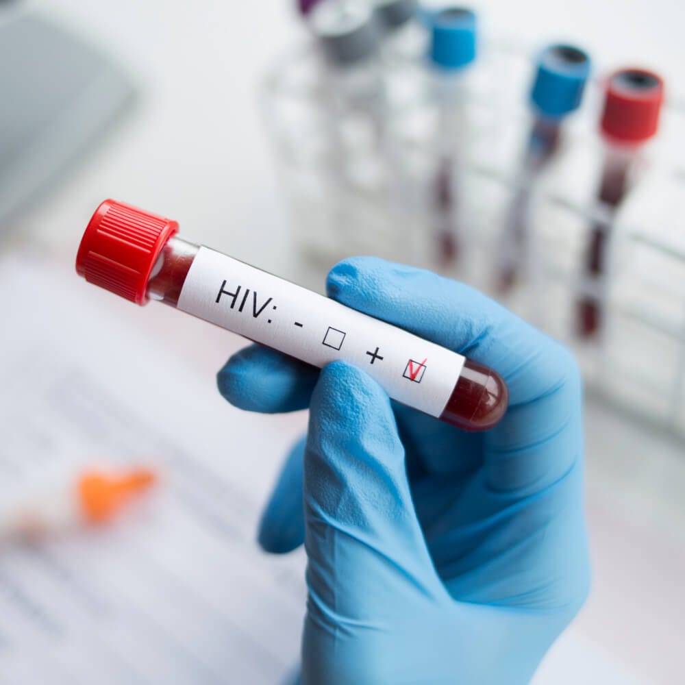 Prueba de sangre para hacer analisis de VIH