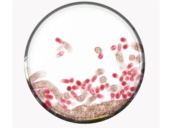 Image of Flu virus under a microscope