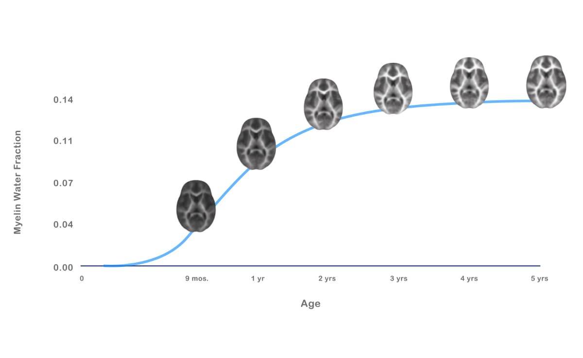 the_explosion_of_myelination_and_synaptogenesis_in_early_life_video_gallery_1_1400x860.jpg