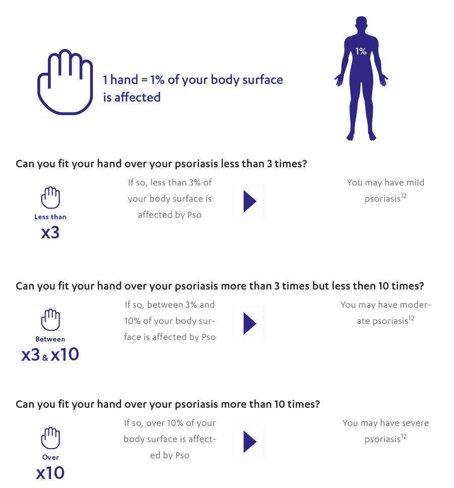 severity checker severity checker