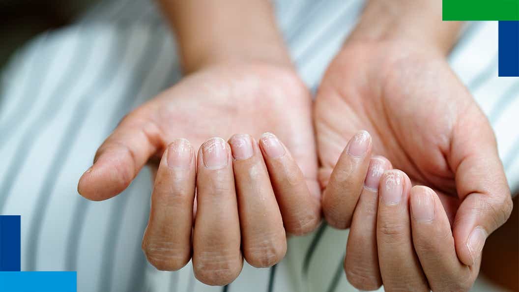 skin and nails skin and nails