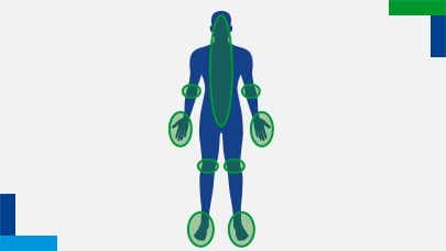 areas affected areas affected