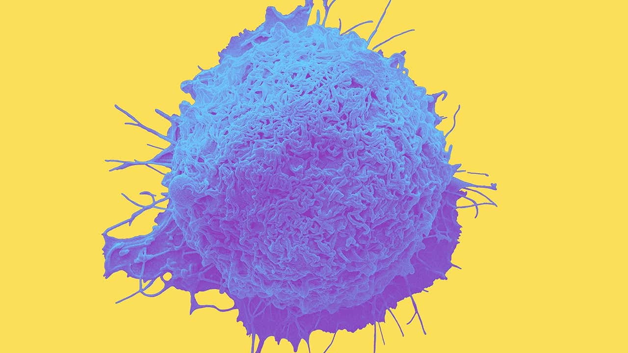 oncology