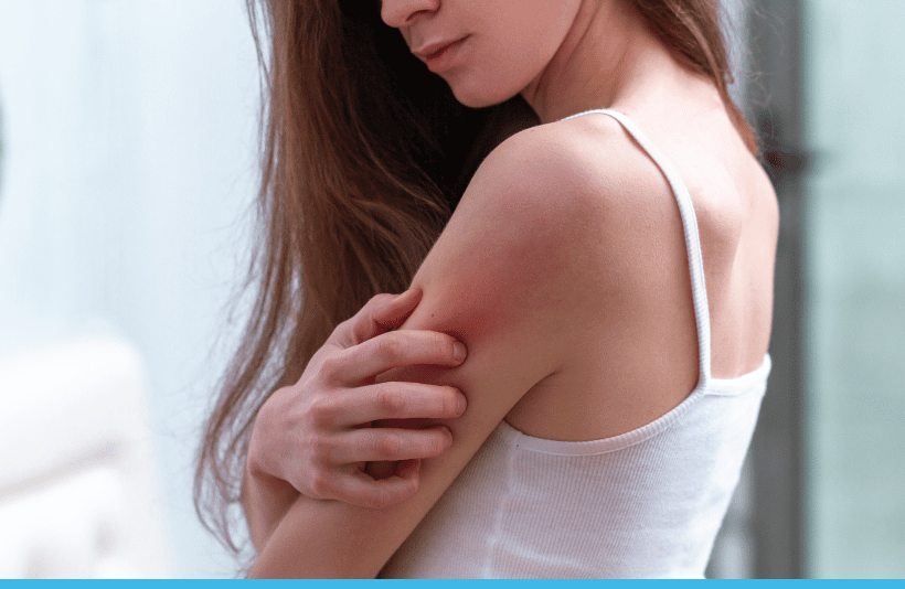 Dermatology-home-nl-nl-psoriasis Dermatology-home-nl-nl-psoriasis