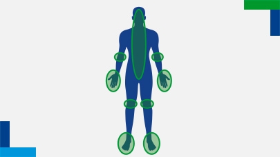 Areas affected by psoriatic arthritis