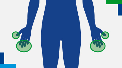Areas affected by nail psoriasis
