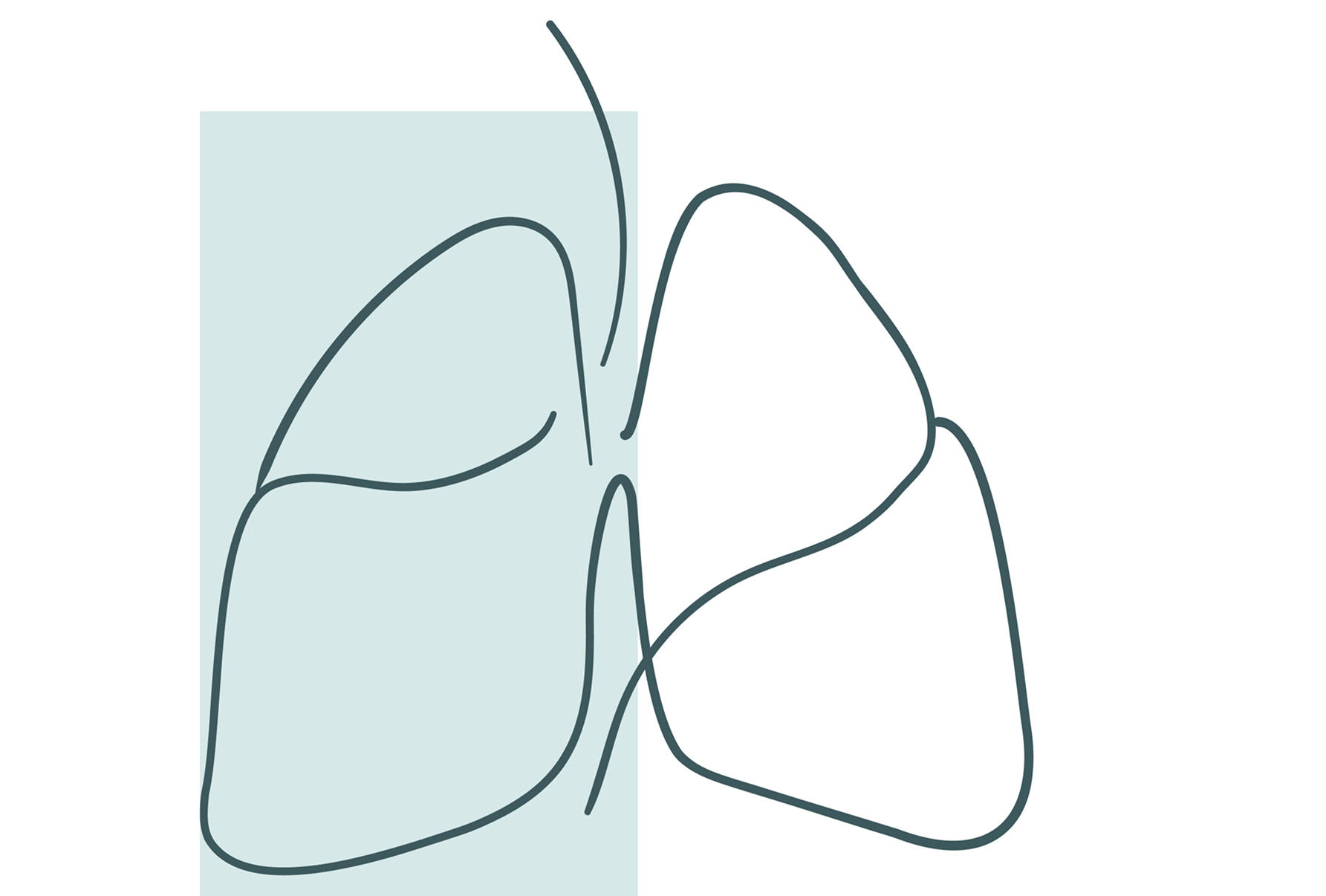 Om lungcancer